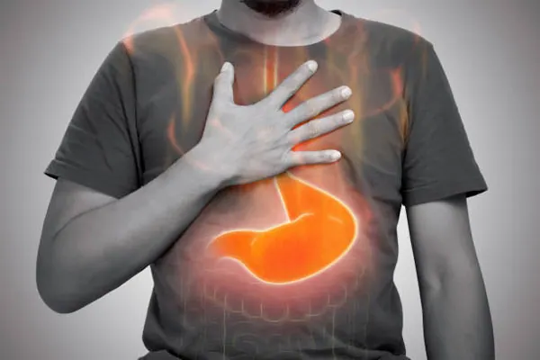Hiatal hernia